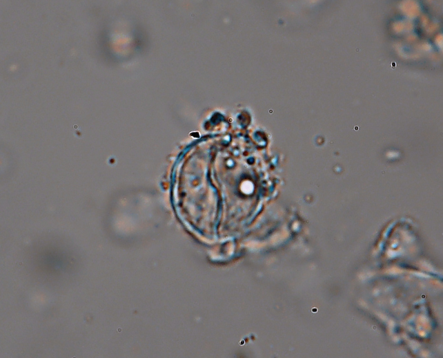 Macchie bianche su nocciolo (Exidiopsis calcea)